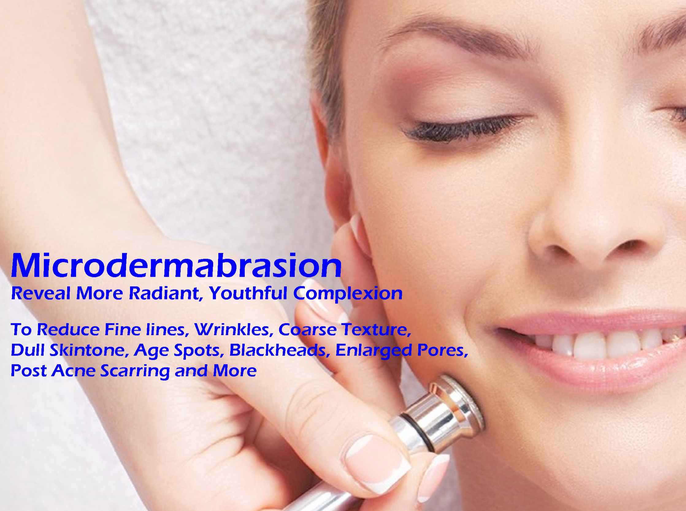 Benefits-of-Microdermabrasion-at-home